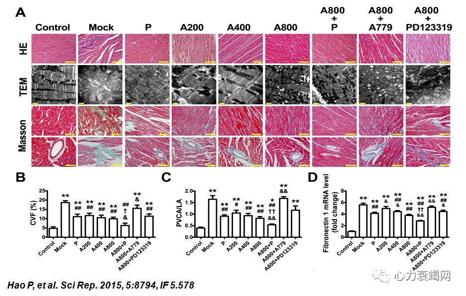 「2019CIHFC」张运教授：ADAM17—糖尿病性心肌病干预的新靶点