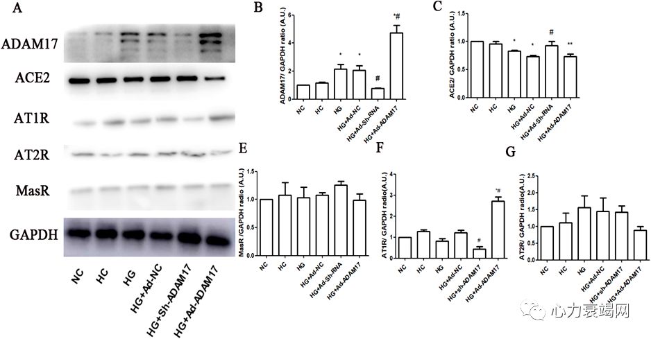 「2019CIHFC」张运教授：ADAM17—糖尿病性心肌病干预的新靶点