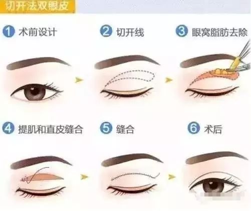 一双漂亮眼睛能拯救一张脸,一双眼睛真的能拯救整张脸