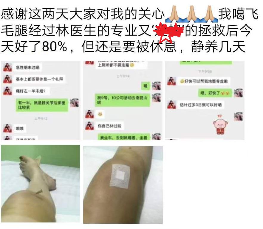 膝盖急性损伤肿过大腿，这样处理后她第二天竟好了八成
