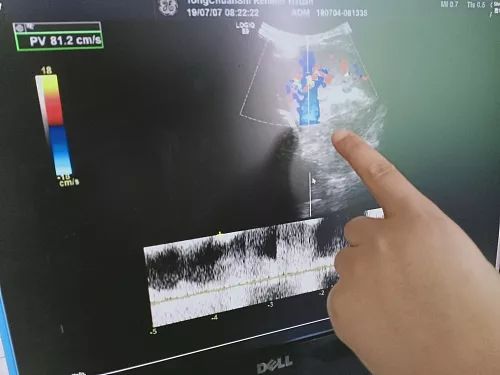 手机扔沙发致11岁孩子脾脏破裂,妈妈扔手机导致宝宝脾脏切除