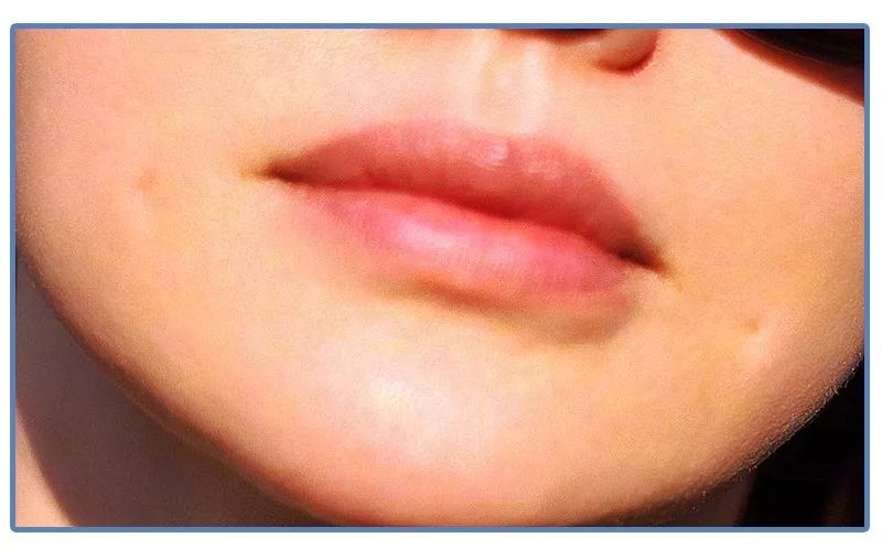 泫雅丰唇后颜值下跌?!但大家都爱这样的“香肠嘴”啊