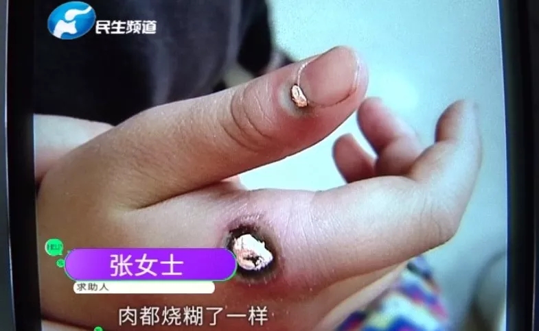 8岁男童烂指甲,8岁男童指甲烂掉