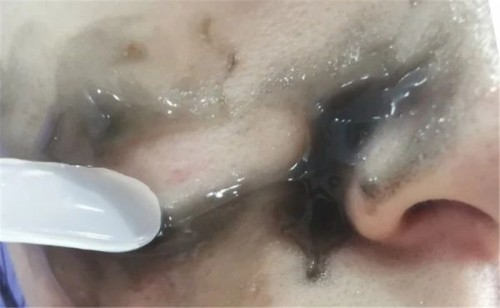 王祖蓝推荐面膜好不好用,王祖蓝推荐贝兰妃面膜