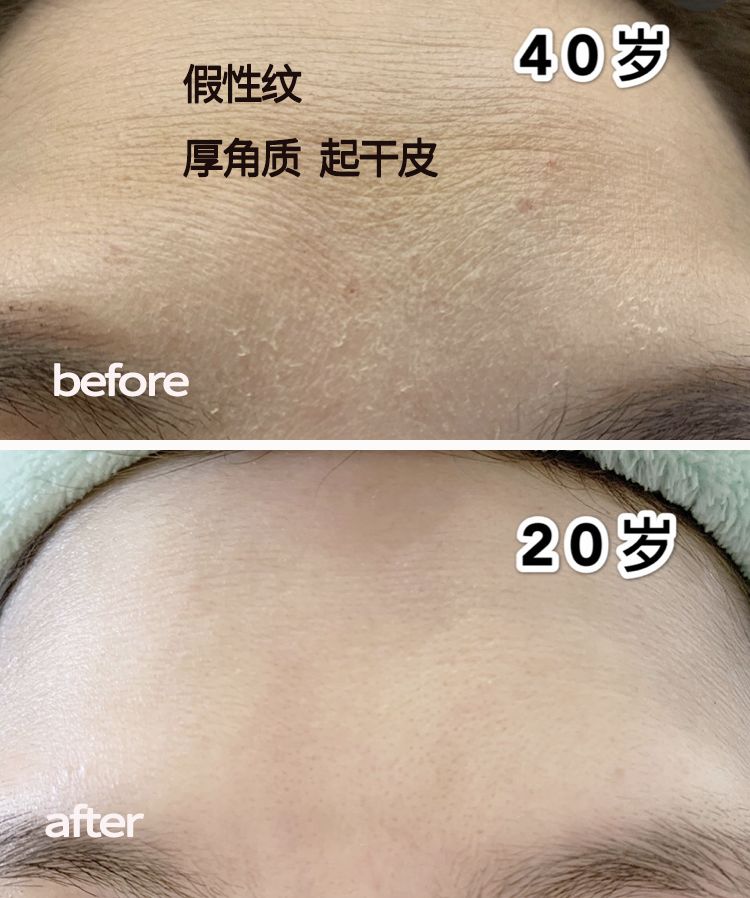 脸上搓出3斤泥！难怪又黄又暗又黑头！10秒给脸蛋“剥壳”，厉害