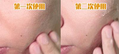 脸上搓出3斤泥！难怪又黄又暗又黑头！10秒给脸蛋“剥壳”，厉害