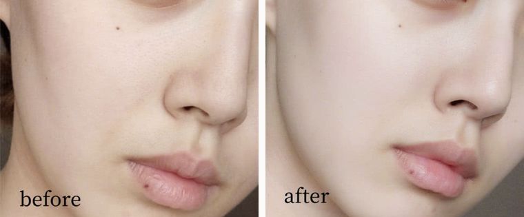 脸上搓出3斤泥！难怪又黄又暗又黑头！10秒给脸蛋“剥壳”，厉害