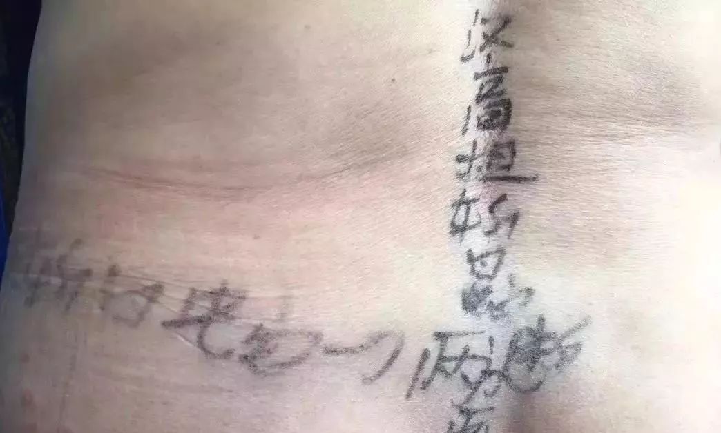 瑙︾洰鎯婂績灏忓,10宀佺敺瀛╄剸瀛愪笂鍏ㄦ槸閽堢溂鏂伴椈