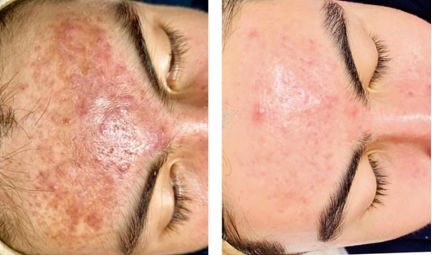 女星秒变“网瘾少女”，3C病“瘾”斑出击，失去远比看到得多