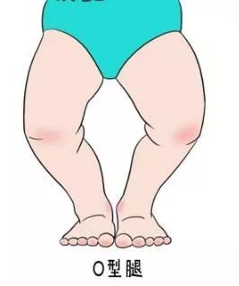 每天跷二郎腿,长期跷二郎腿的五大严重后果