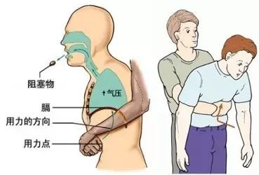 健康丨超实用的急救方法，建议每个人收藏