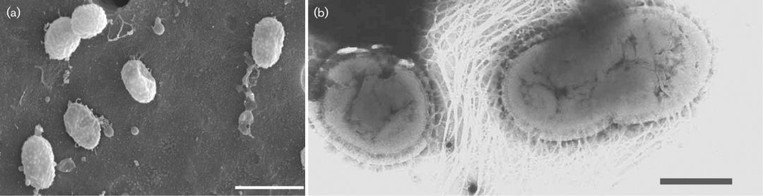 akk益生菌,益生菌akk瘦子菌推荐