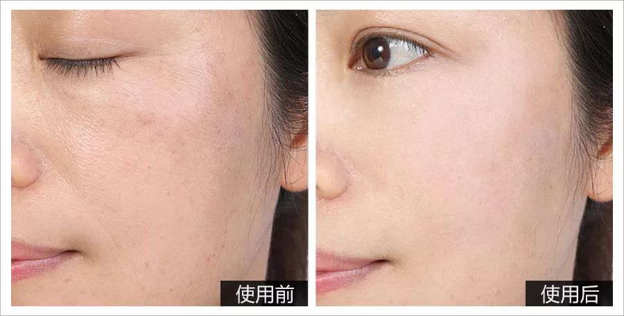 39岁宋慧乔完美复出御姐范十足,37岁宋慧乔重拾颜值巅峰