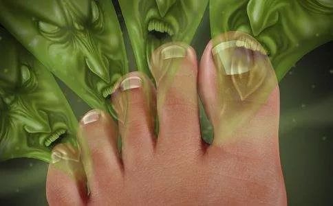 也许你没去过香港，但你一定听说过“香港脚”