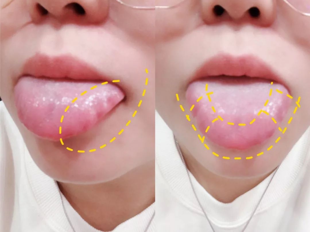 自曝体质特异,一天8杯奶茶喝不胖,粉丝惊呼太夸张