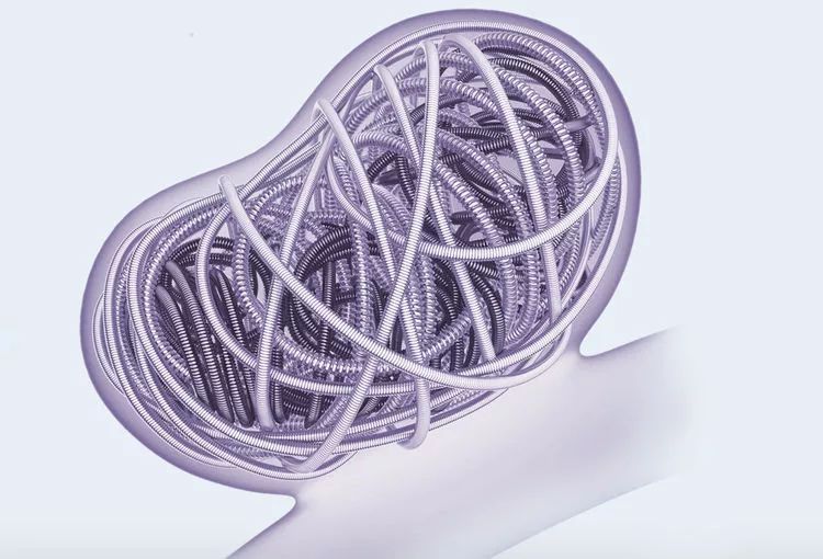 柳暗花明·第58期｜颅内动脉瘤栓塞时弹簧圈的选择（一）