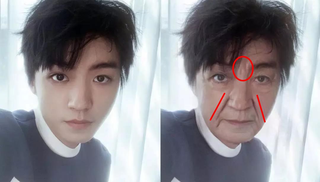 35岁了法令纹鱼尾纹眉间纹怎么办,三十岁就有眉间纹法令纹怎么办