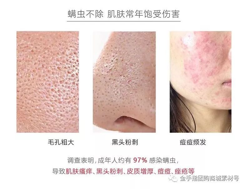 金手指团购券,金手指线上团购