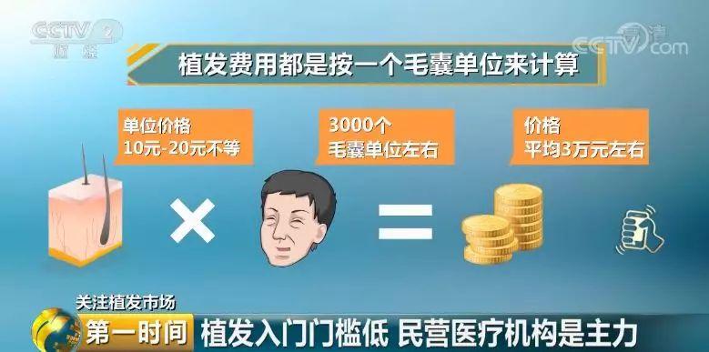 头顶脱发植发有用吗,中国脱发人数2024