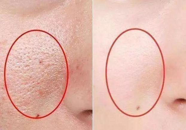 睡眠乳胶枕推荐,给大家推荐一款乳胶枕