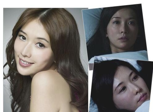 皮肤出现红血丝怎么治,皮肤红血丝怎么治疗和修复