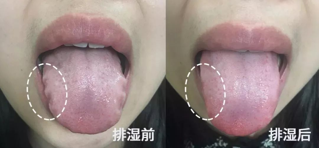 用它泡脚能赶走5种病,一个泡脚小药方赶走多种病