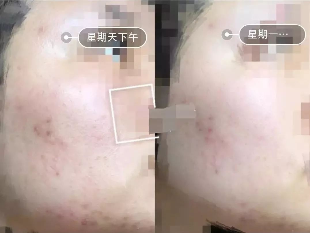 美白精华让你整个夏天都白得发光,美白精华猛料推荐