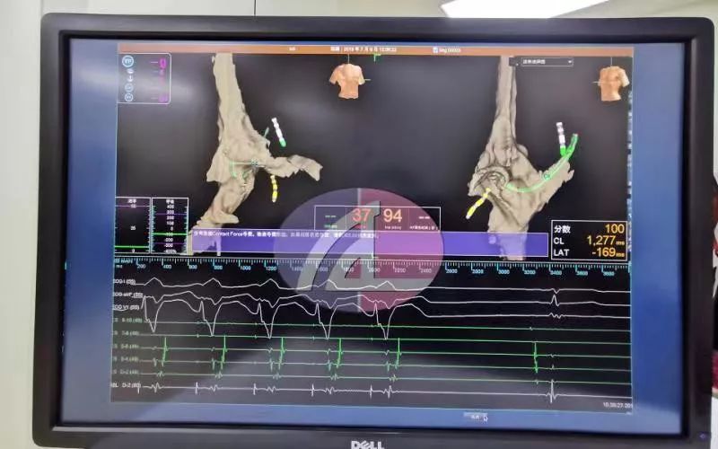 心肺复苏按压24小时,2020小儿心肺复苏按压频率及深度