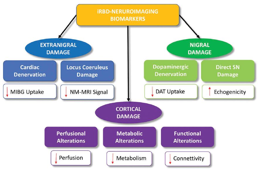 快速眼动期睡眠行为障碍中医治疗,快速眼动睡眠障碍症能活多久