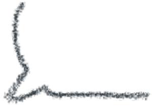 早孕孕酮低怎么办,早孕孕酮低hcg正常