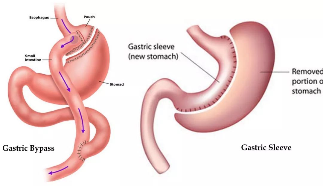 父亲精子正常会不会遗传给儿子,父亲的精子质量会遗传吗
