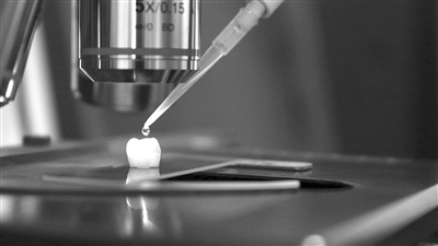 牙齿有缺损可以涂氟吗,牙齿修补液可以修补缺失牙吗