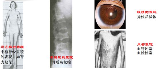 健康评价新指标,健康指标大全详解