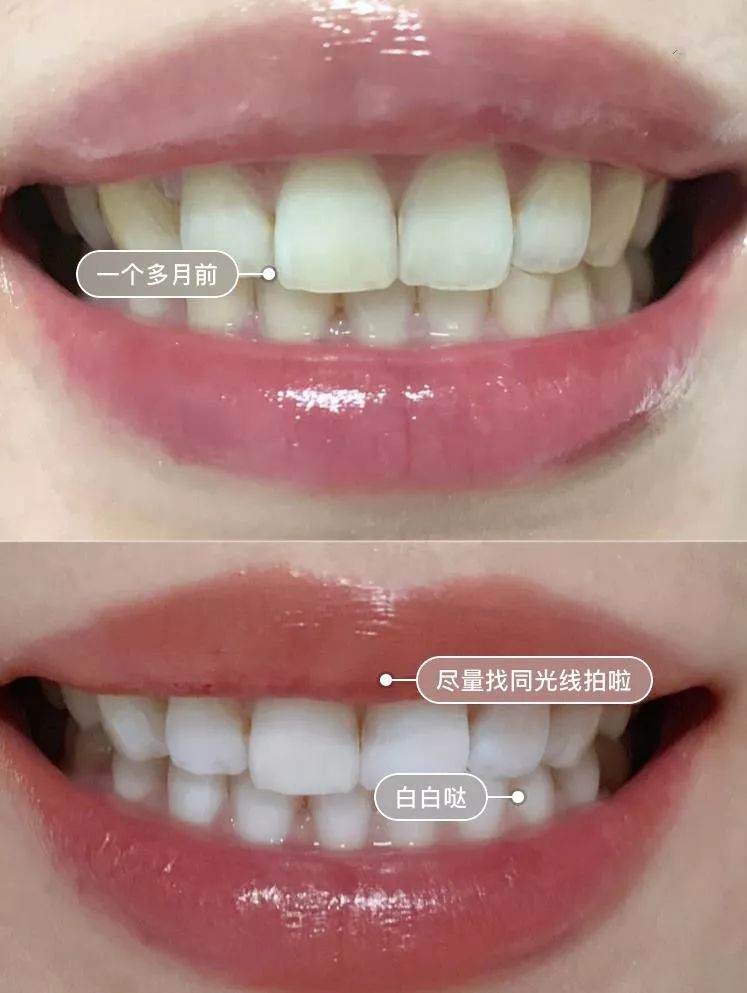 团购|俄罗斯亮白牙膏组合，轻松瓦解多年牙垢，清新口气告别黄牙