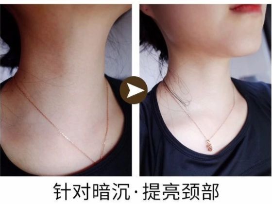 蛋白贴去皱,胶原蛋白颈纹贴