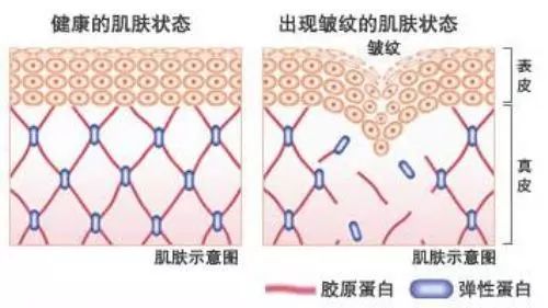 蛋白贴去皱,胶原蛋白颈纹贴