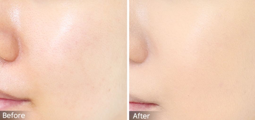 干皮粉底液持久不脱妆秋冬,干皮女孩的护肤品