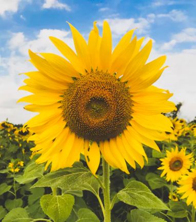 Whipple病、纹状体手、神经结节病、脱髓鞘假瘤丨3分钟读片·第16期