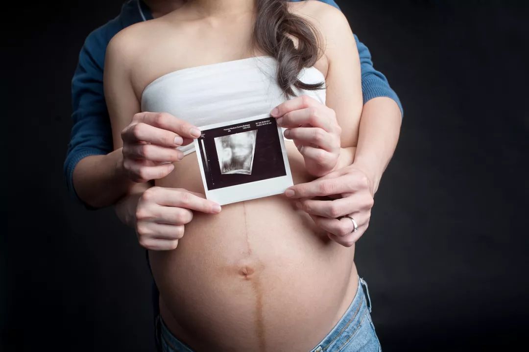 剖宫产率居高不下的原因,剖腹产率居高不下的原因