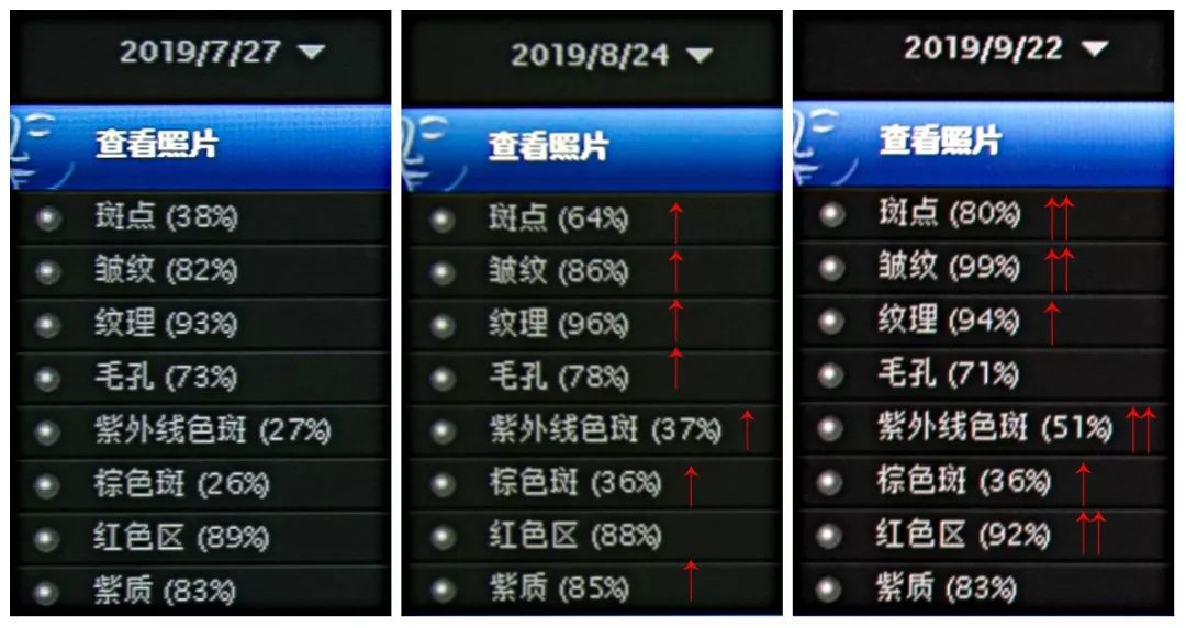 肌诊室水光肌挑战,肌诊室修复