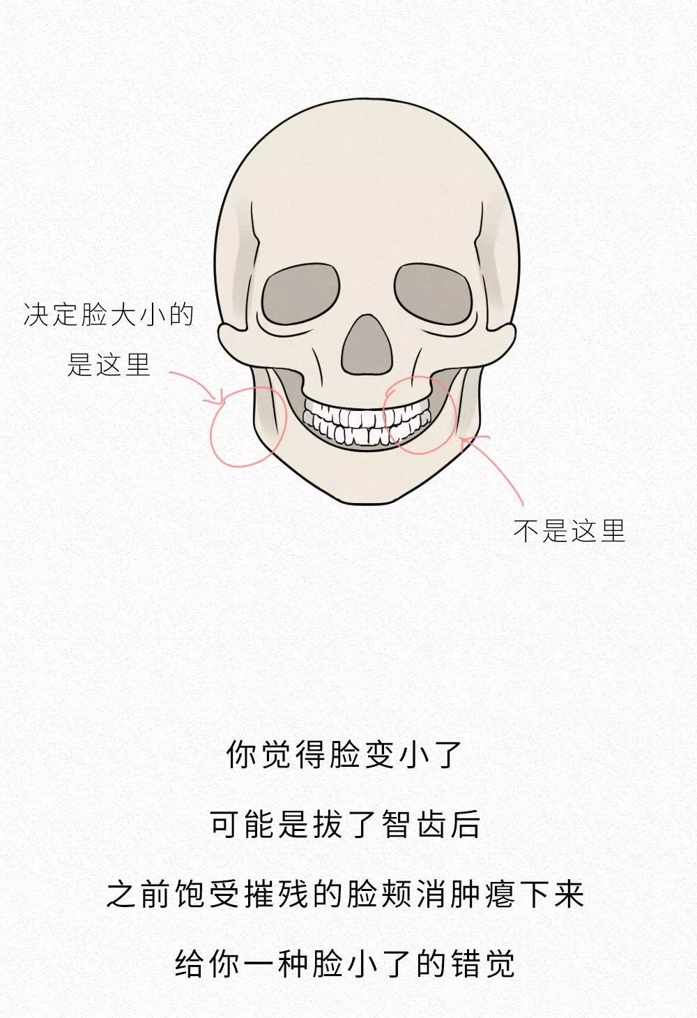 拔智齿的全过程漫画,智齿漫画版