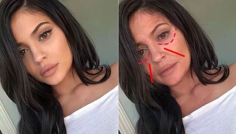 法令纹眼纹一个都逃不掉,法令纹和眼纹怎么才能有效改善