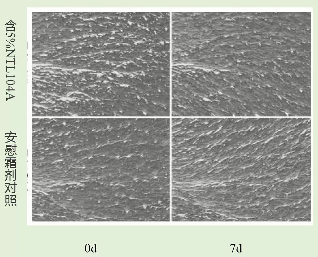 法令纹和眼纹怎么才能有效改善,法令纹贴眼贴有用吗