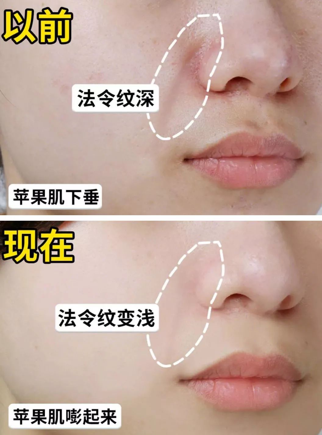 眼膜贴八小时紧致抗皱淡细纹,官方眼膜紧致抗皱淡细纹法令纹