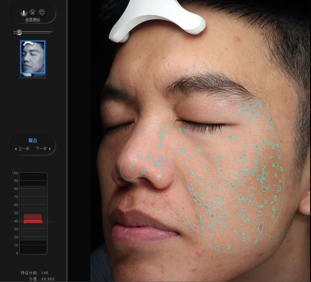 五周年福利｜皮肤“照妖镜”VISIA免费体验！定制你的皮肤管理方案，浙大四院五周年福利持续放送中