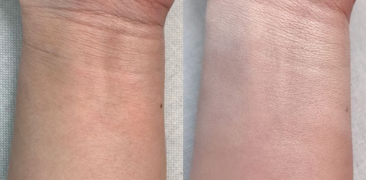 11款热门遮瑕合集,遮瑕笔强力遮斑测评