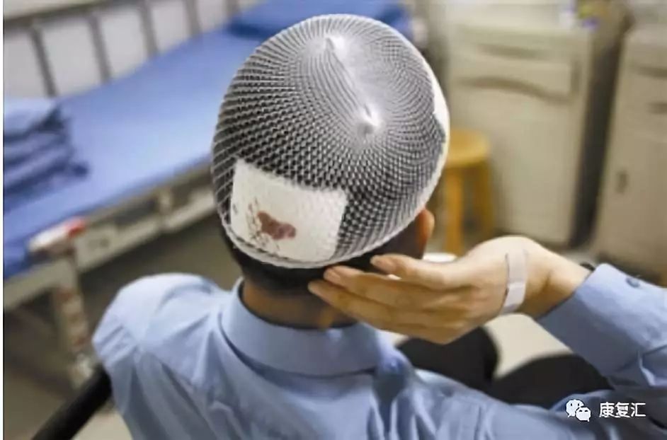 脑外伤后的功能康复