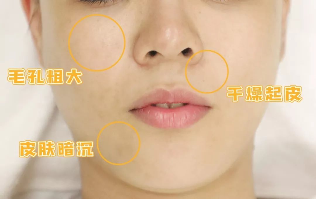 1元体验“爱马仕”级的变美服务，限量100份，再不抢就没了