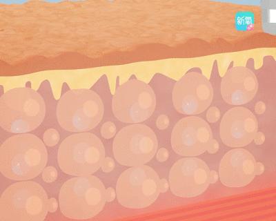 1元体验“爱马仕”级的变美服务，限量100份，再不抢就没了