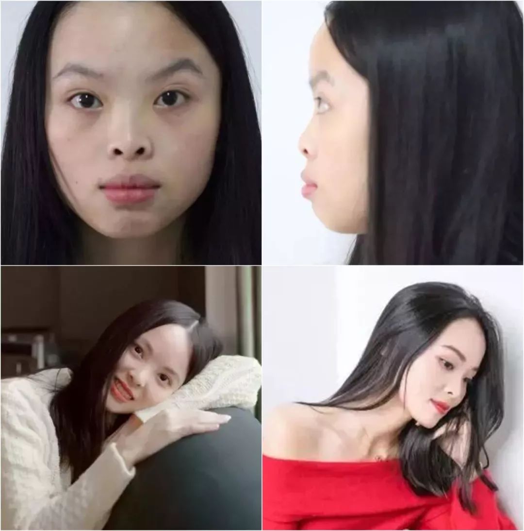 最短只要一年，这件事做对了堪比整容